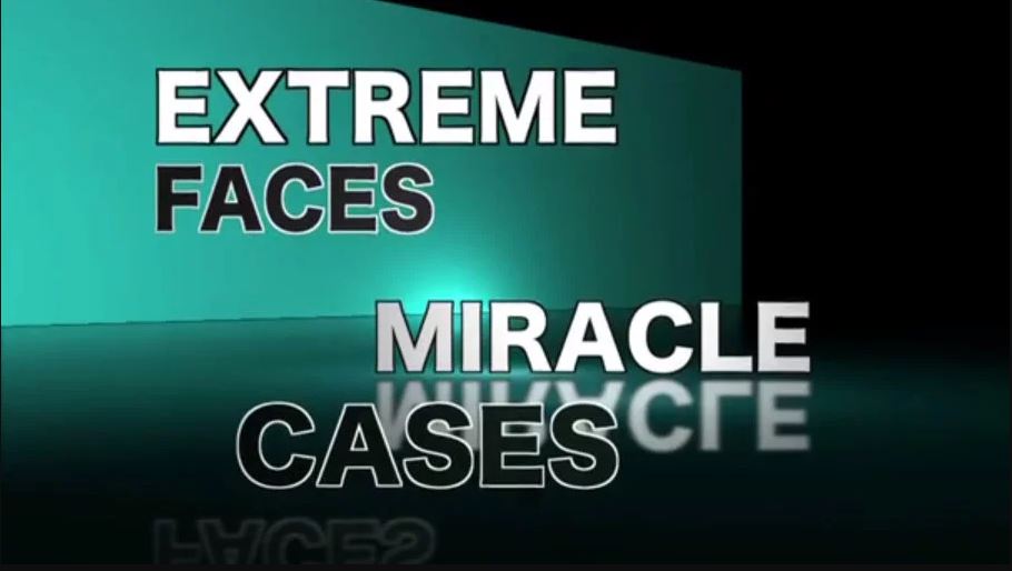 Extreme Cases Miracle Faces - Dr. Gibson Patients